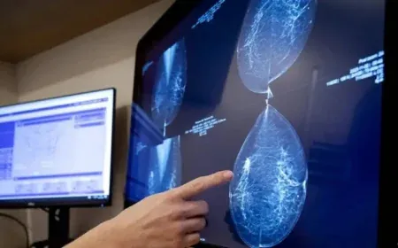 Mô hình AI mới dự đoán nguy cơ ung thư trong 5 năm